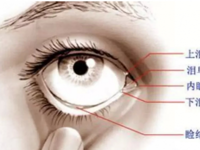 了解淚道疾病的那些事兒